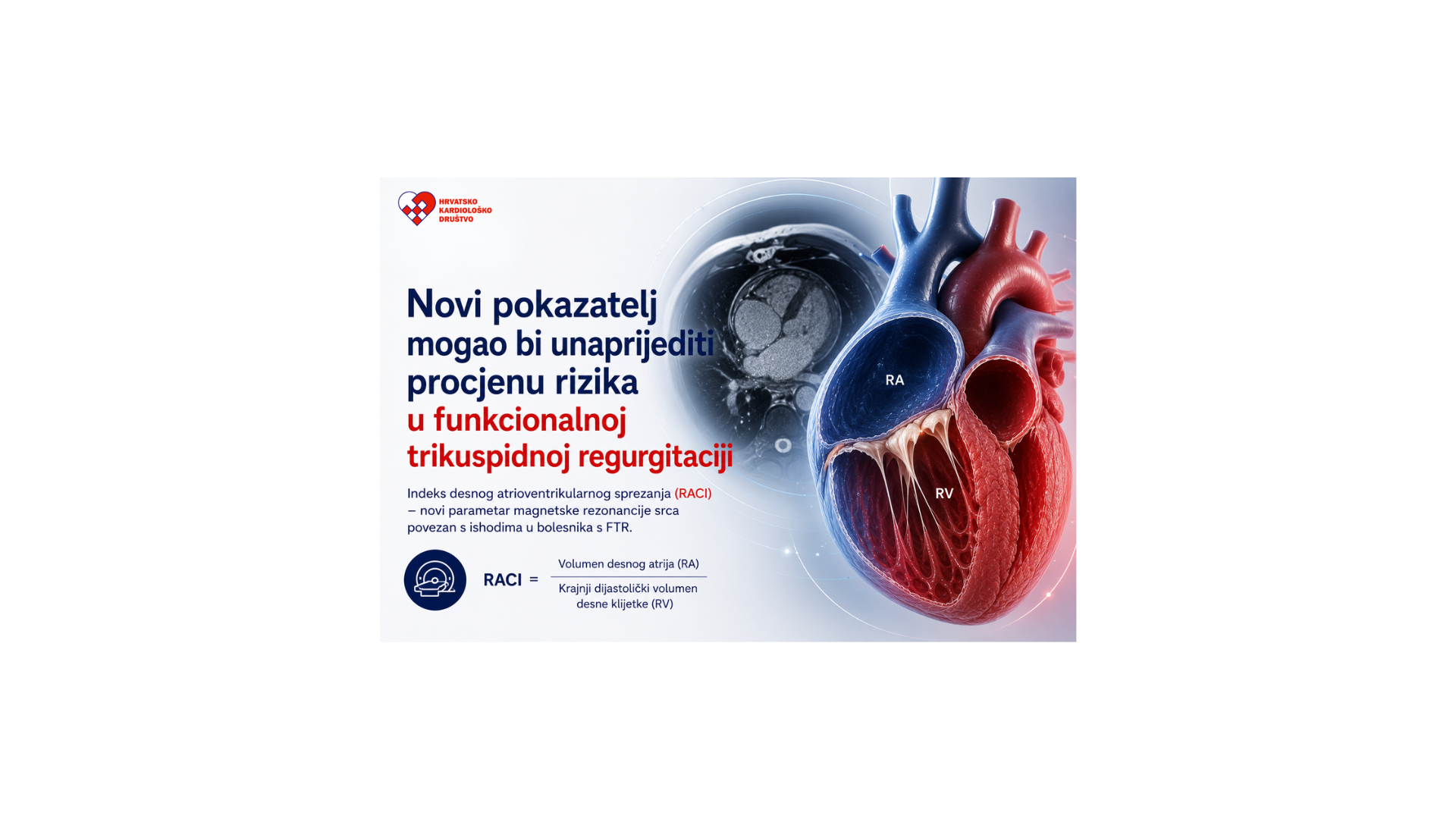 Novi pokazatelj mogao bi unaprijediti procjenu rizika u funkcionalnoj trikuspidnoj regurgitaciji